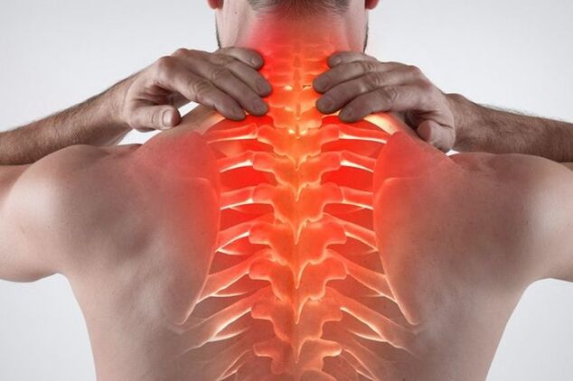 Osteocondroza coloanei vertebrale toracice: simptome și tratament - Hondrogel